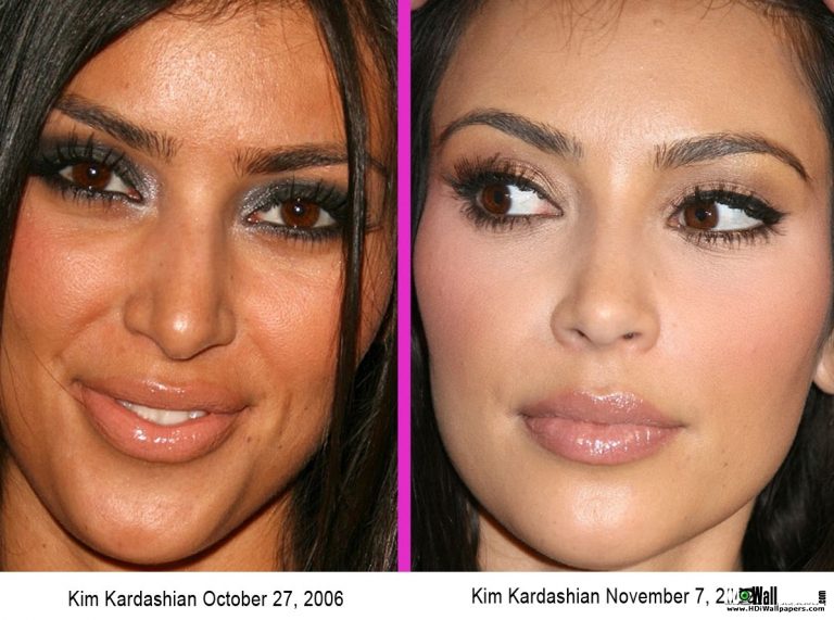 Kim’s NEW BODY Diet and exercise or plastic surgery?