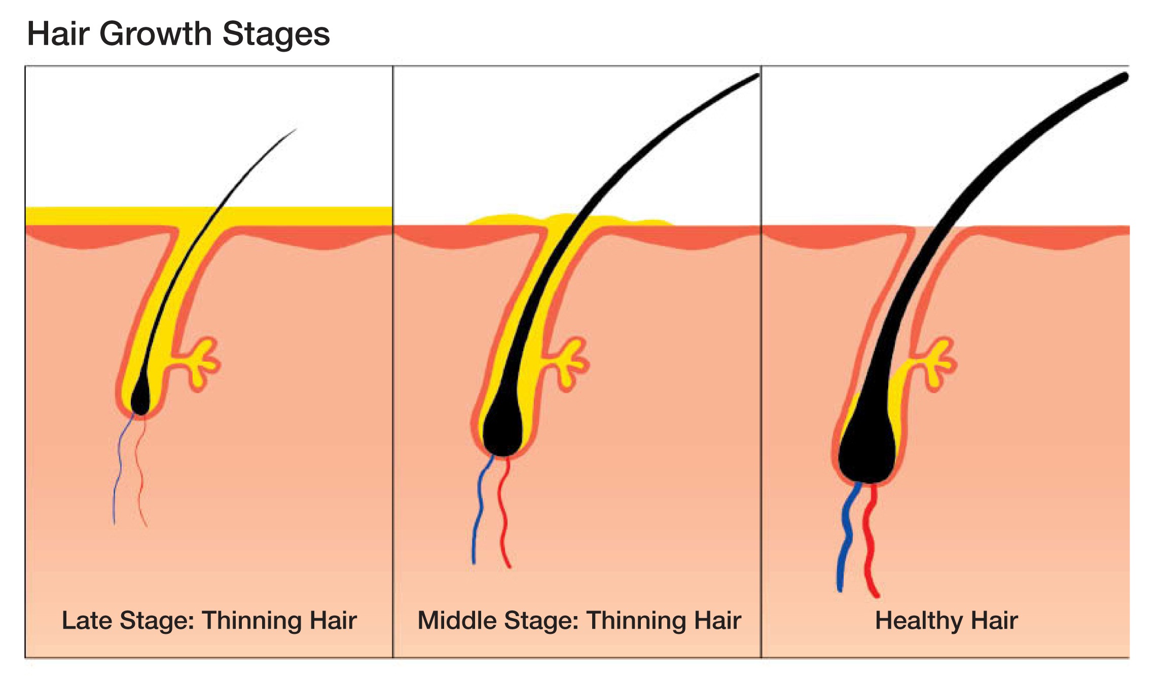 Regrow Your Hair In Fastest Way Naturally Teronga